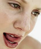 tongue burns