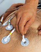 ECG